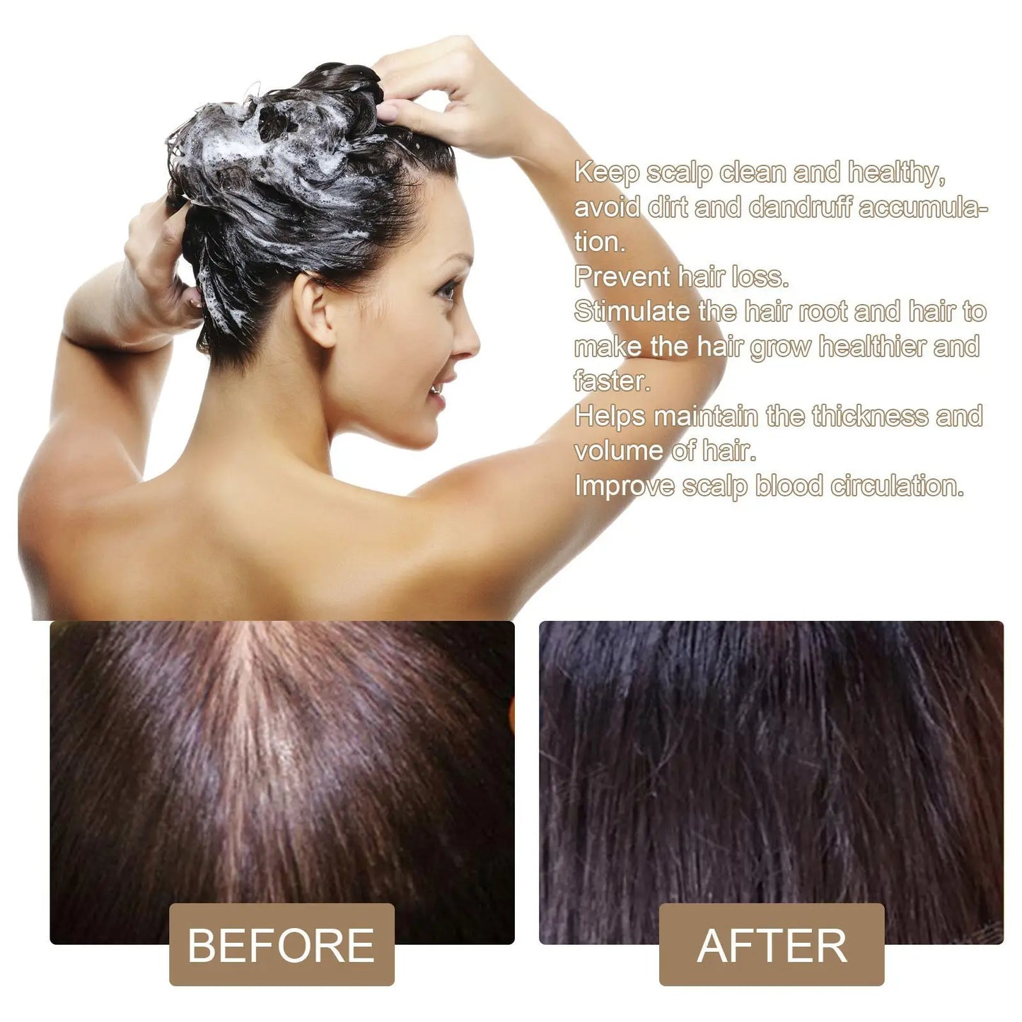 Rice Shampoo Bar Promote Hair Growth Anti Hair Loss Strengthen Hair Roots Scalp Care Dandruff Treatment Volumizing Shampoo Soap