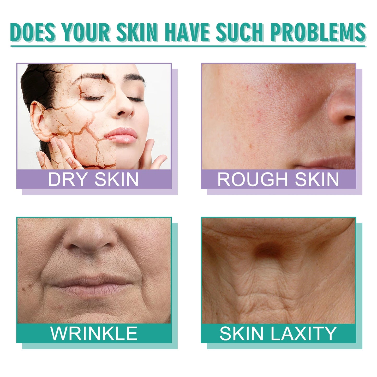 Hoygi Moisturizing Polypeptide Cream Skin Care Firming Wrinkle Removal Smooth Anti Aging Face Cream for Dry And Rough Skin