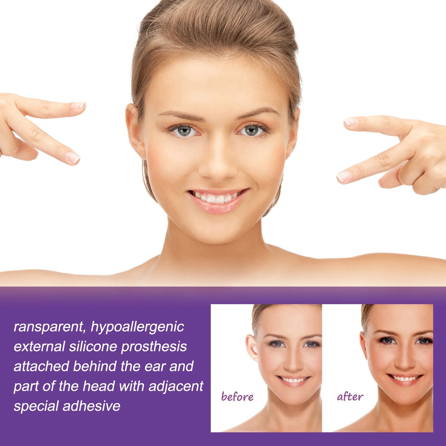 Eelhoe 6pcs Ear Corrector Support Frame Discreet Appearance Waterproof Secure Hold Reshape Protruding Ears Contour Natural Care