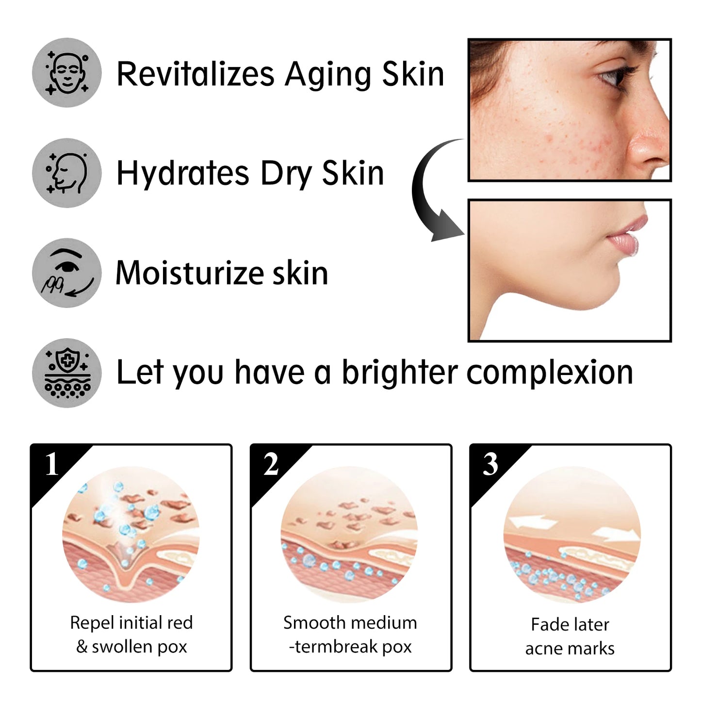 Advanced Snail Face Cream Whitening Repair Soothes Red Sensitized Skin Moisturize Anti Aging Snail Mucin Facial Care Cream