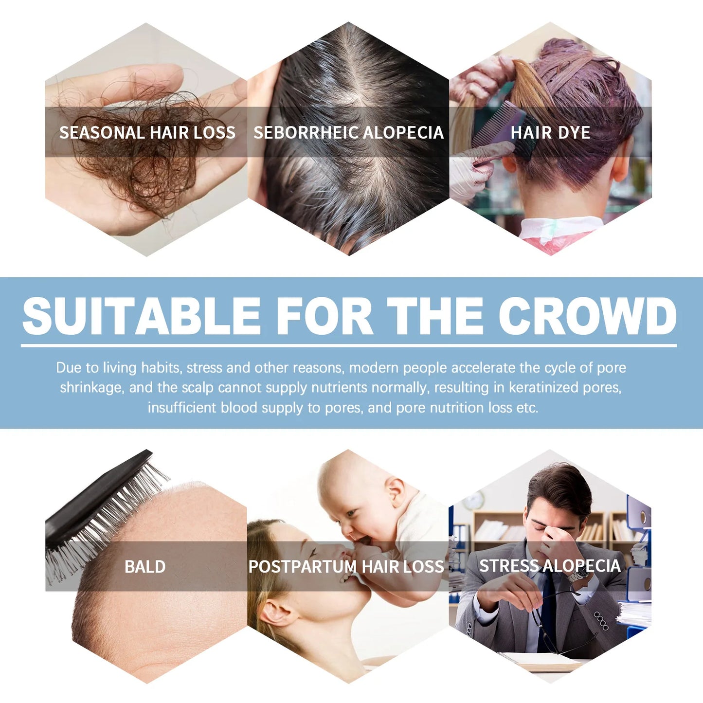 Eelhoe 2mlx7 Instant Hair Reborn Ampoules Anti Hair Loss Nourish Scalp Smooth Repair Regrowth Thicken Hair Strength Ampoules