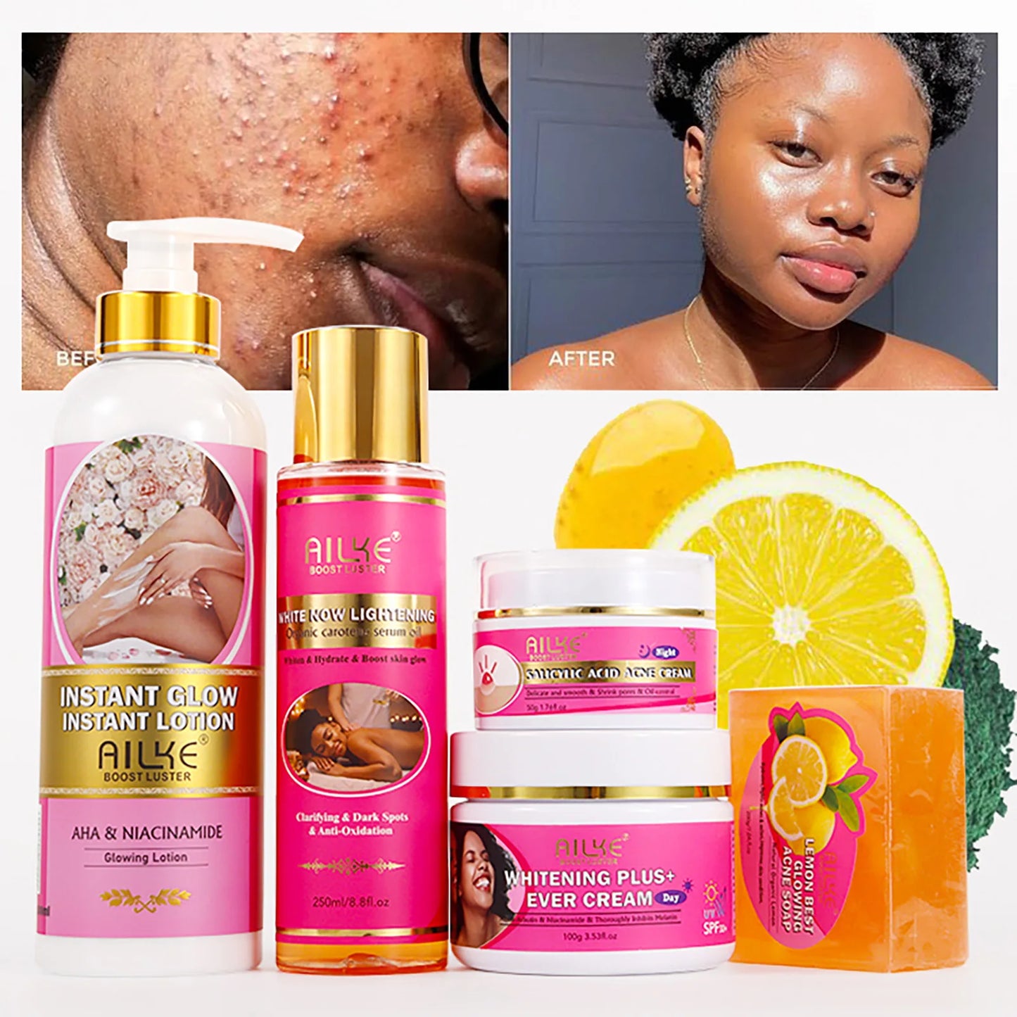 AILKE AHA Organic Skin Brightening Set, Whitening Lotion, Reduce Dark Spots, Clarify, Cleaning, Moisturizing, for All Skin Types