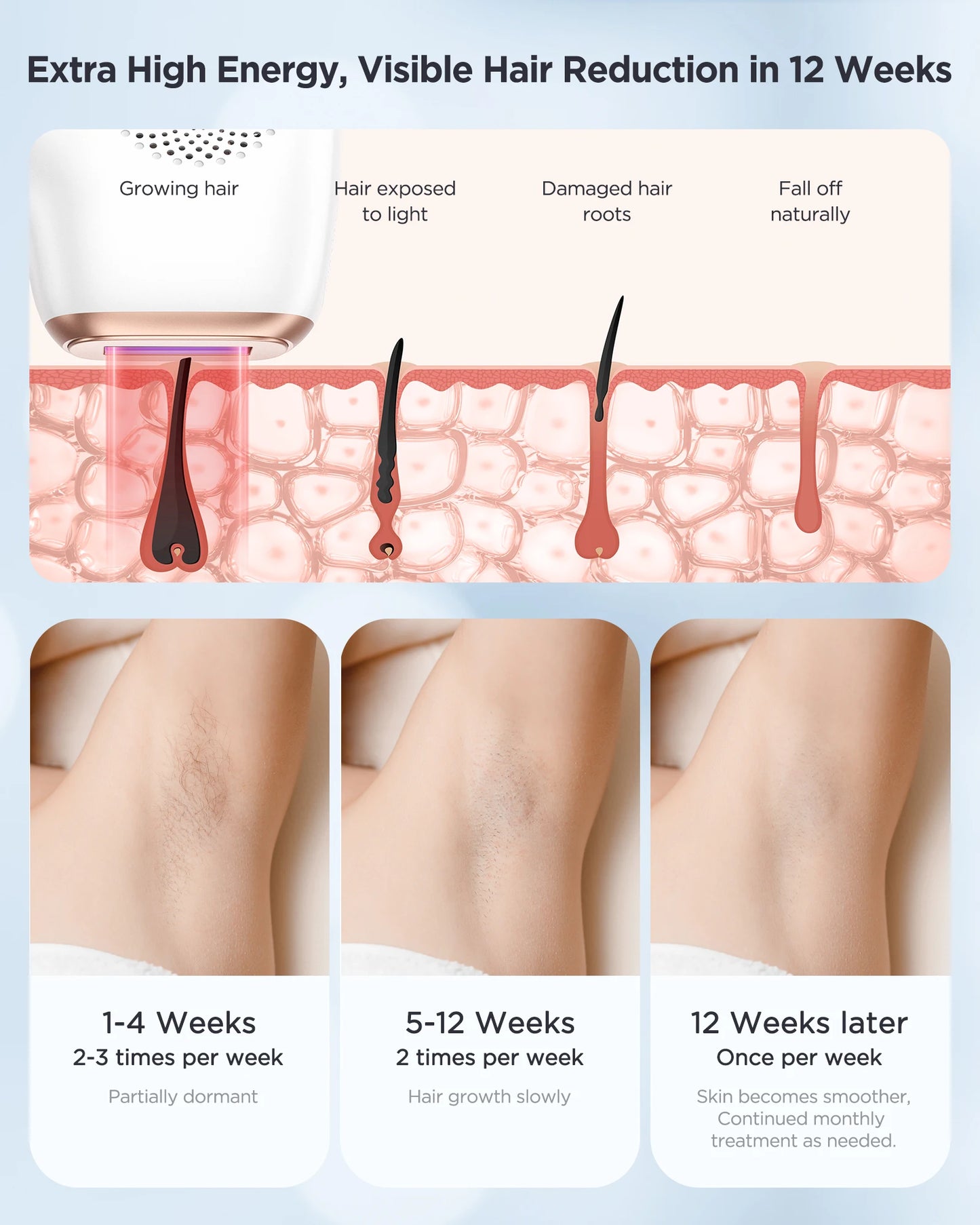 INNZA Hair Removal IPL Painless Permanent Removal Ice Cooling Care for Men and women Armpits Legs Arms Bikini Line Facials