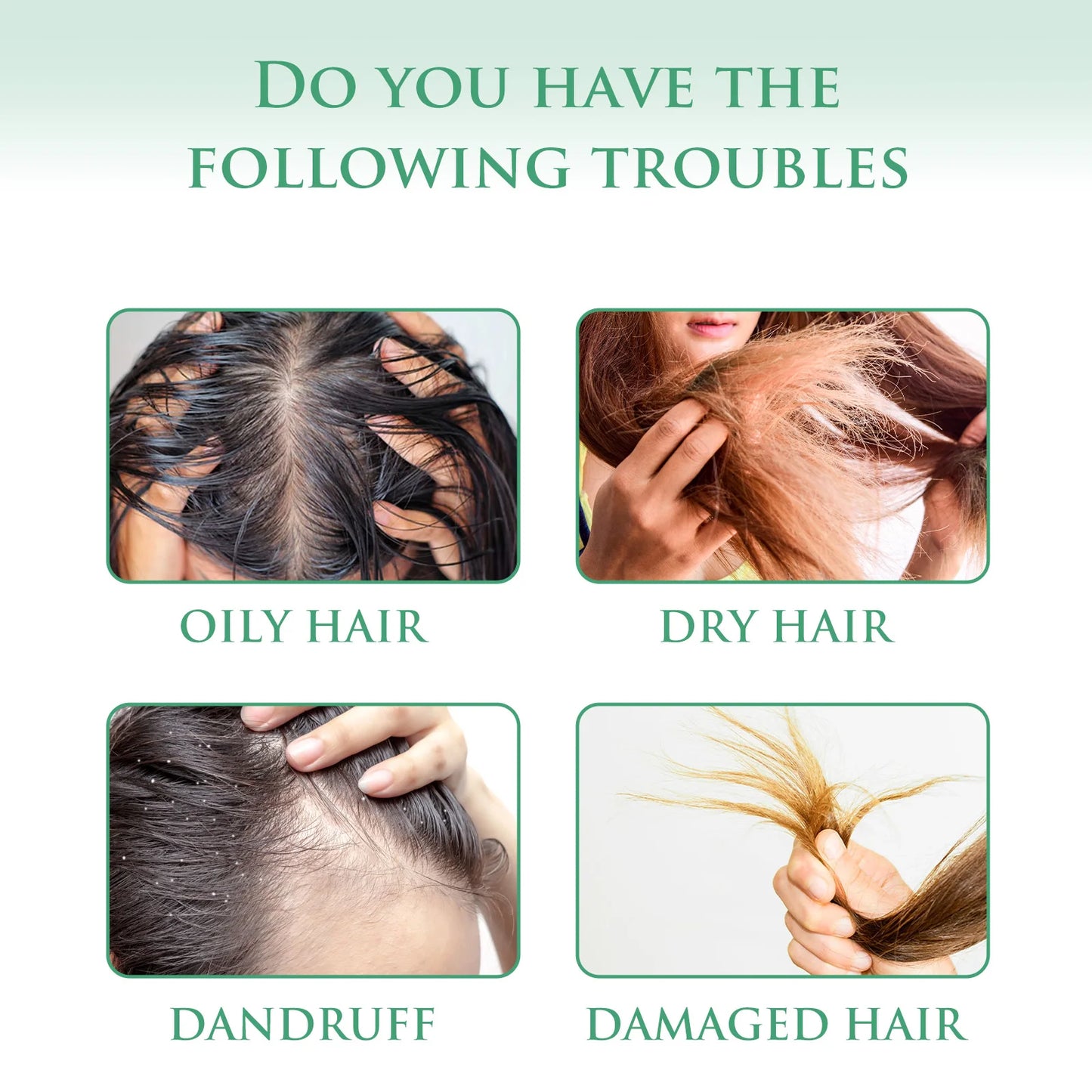 Anti Dandruff Shampoo Oil Control Repair Split Ends Damaged Refresh Moisturizing Nourish Scalp Treatment Cleansing Shampoo Soap