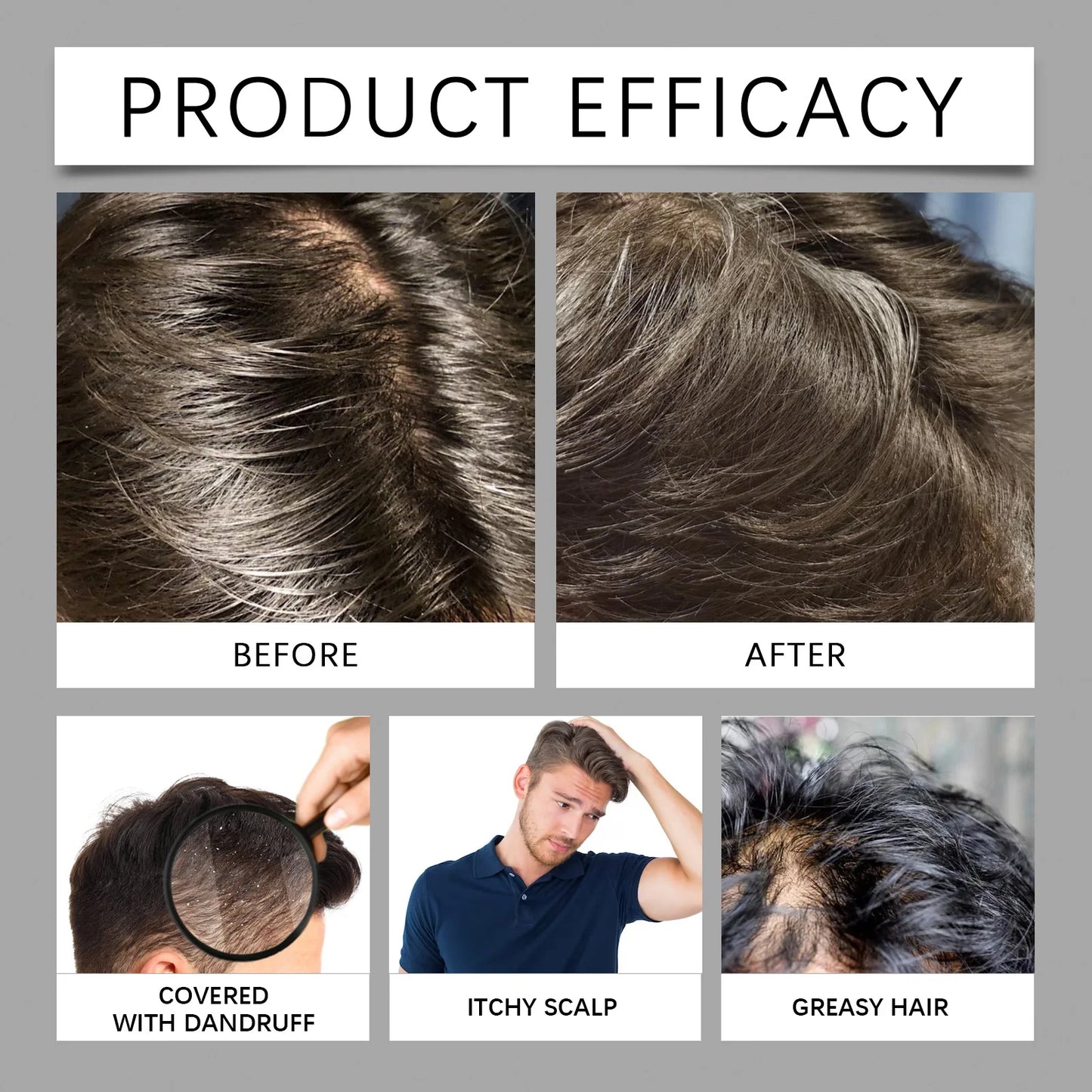 Men Hair Care Set Improve Dryness Roughness Non-greasy Fluffy Thickening Nourishing Volumizing Hair Shampoo and Conditioner Set