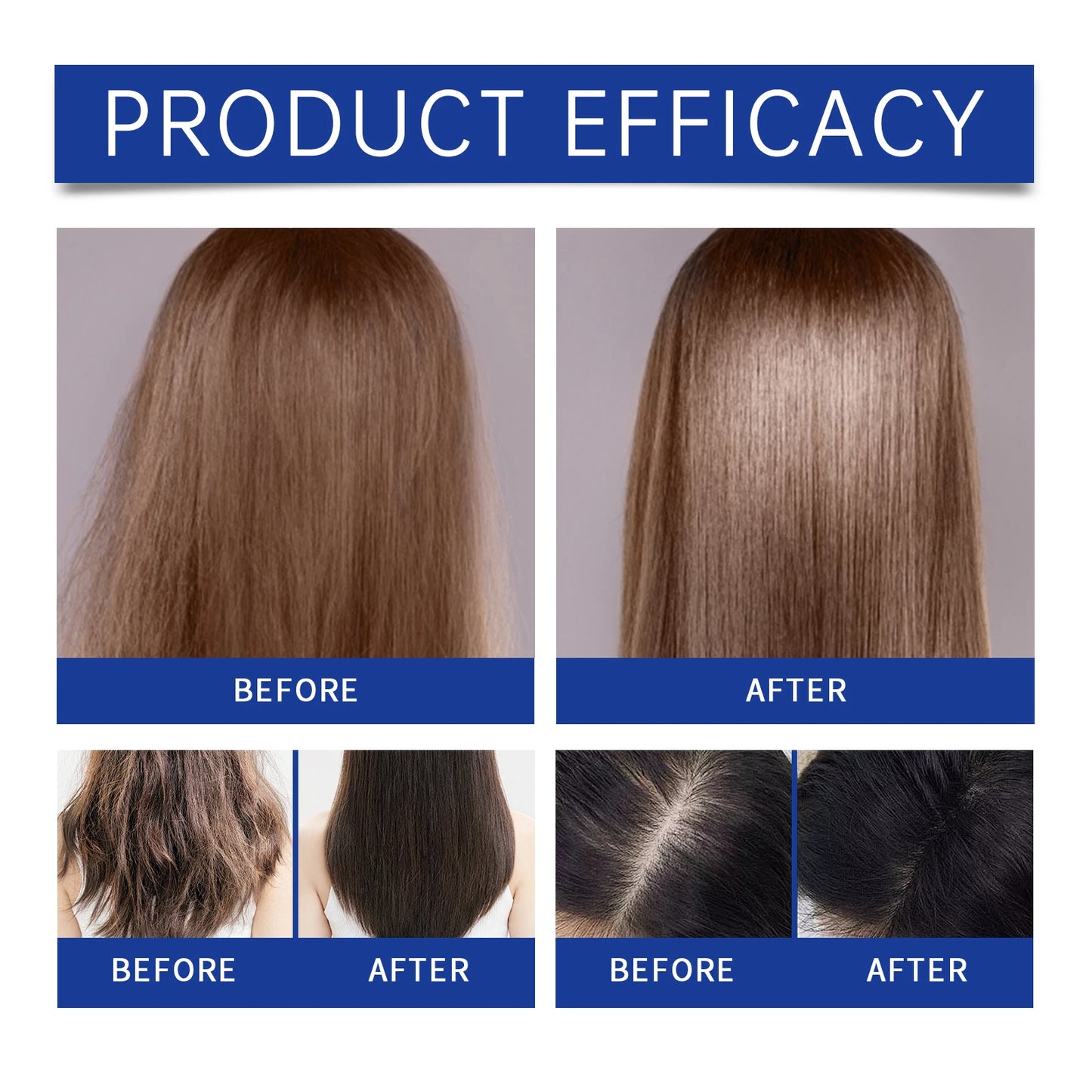 Hyaluronic Acid Complete Hair Care Kit Anti Breakage Smoothing Soft Hair Deep Conditioning Castor Oil Hair Growth Serum