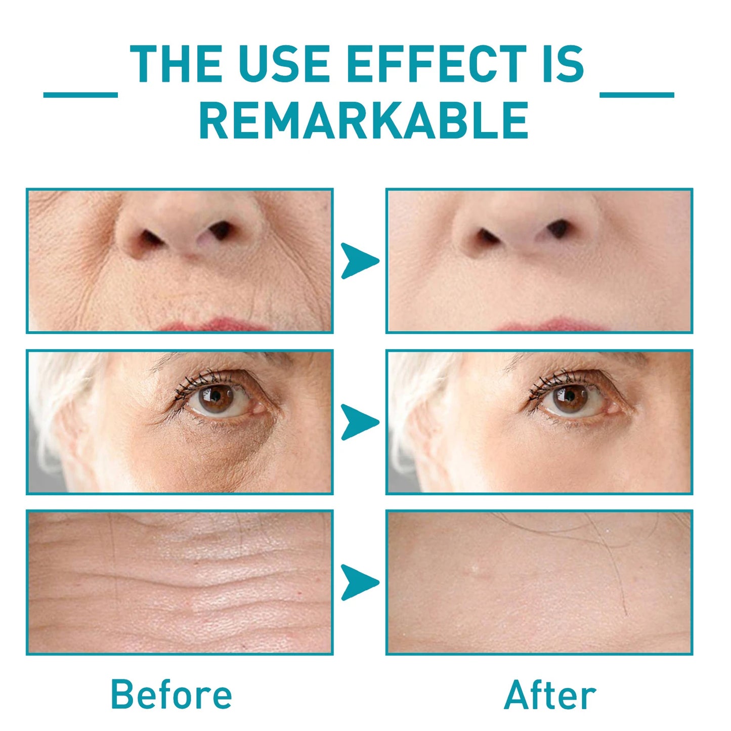 Anti-Wrinkle Serum Skin Repairing & Lightening Crow's Feet Firming Serum with Convolvulus Peptide