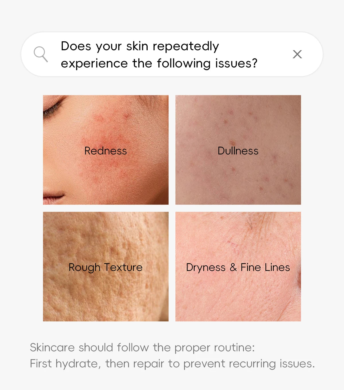 8X H2O AquaVitalize Skincare Set 5PCS Deep Hydration Kit Wrinkle Smoothing Tightening Treatment Gift Set